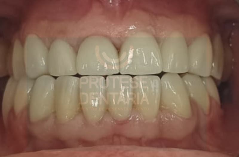 Foto 2 de RMS Prótese Dentária