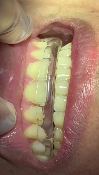 Foto 3 de RMS Prótese Dentária