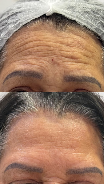Foto 2 de Ro Estética Itu - Allure Clínica Estética