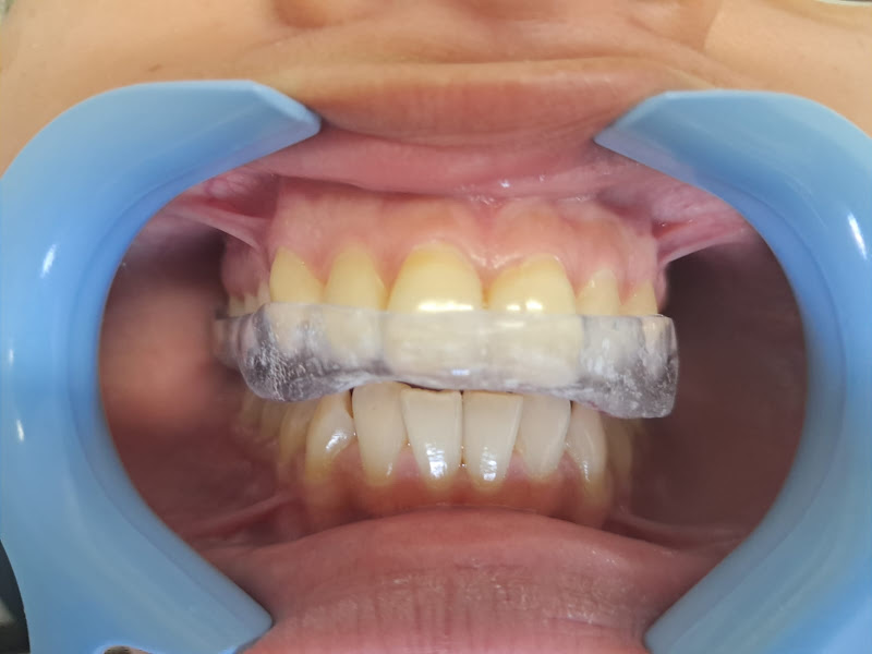 Foto 3 de Roberto Pedras, DDS, MSc, Especialista em Disfunção Temporomandibular (DTM) e Dor Orofacial (DOF)