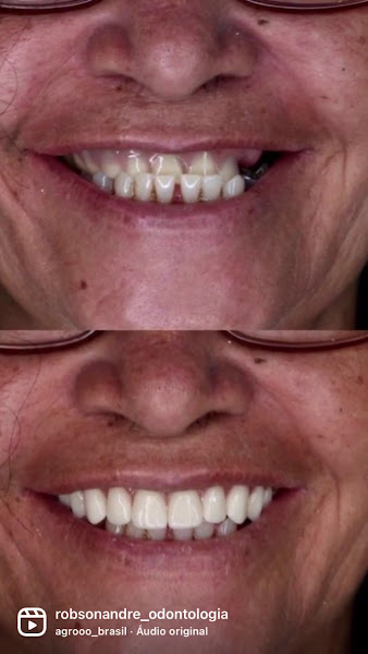Foto 3 de Robson André | Dentista
