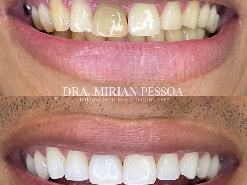 Foto 9 de Robson André | Dentista