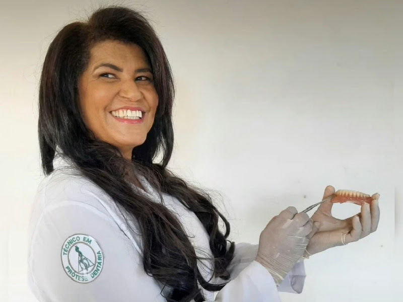 Foto 6 de Robson Protético