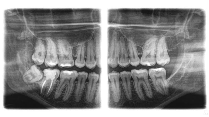 Foto 3 de RODIG - Radiologia Odontológica Digital
