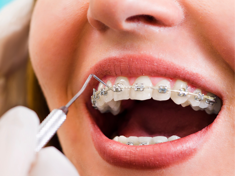 Foto de Rodrigues Alves