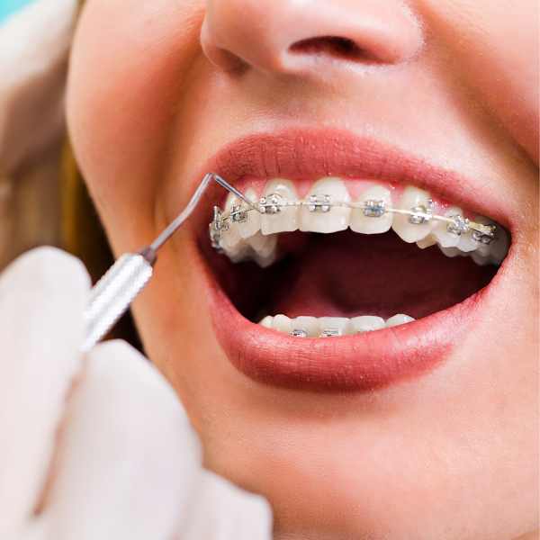 Foto 2 de Rodrigues Alves