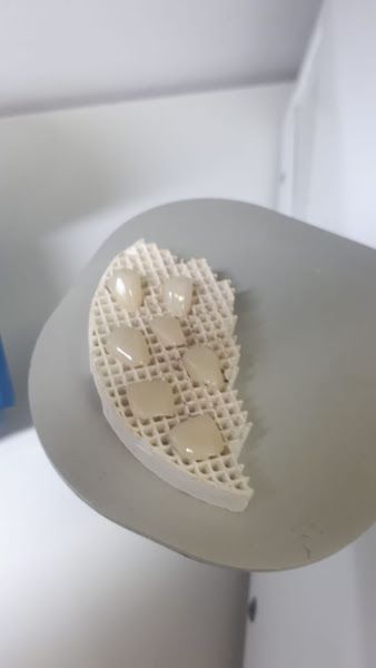 Foto 3 de Rofe Aliança Prótese Dentária