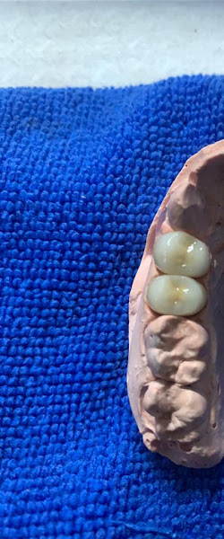 Foto 2 de Rogerprotese Laboratório Dentário