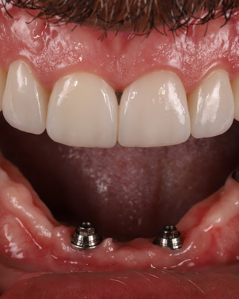 Foto 3 de Romero Fernandes Odontologia - Implante Dentário com os melhores Dentistas da Barra da Tijuca