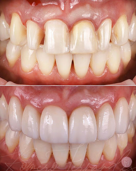 Foto 5 de Romero Fernandes Odontologia - Implante Dentário com os melhores Dentistas da Barra da Tijuca