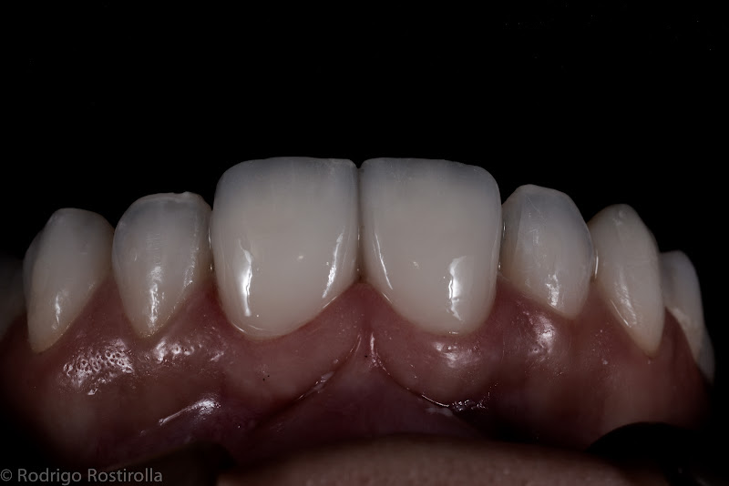 Foto 2 de Rostirolla Odontologia