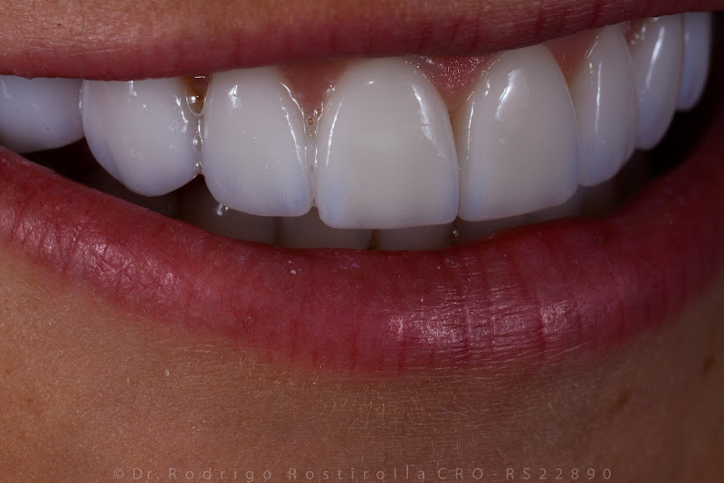 Foto 3 de Rostirolla Odontologia