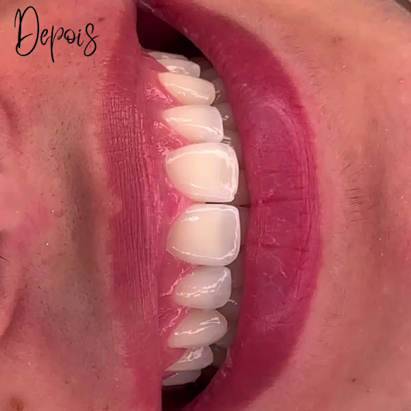 Foto 3 de Rovaris Odontologia Especializada
