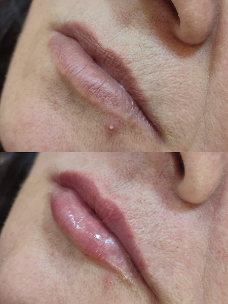 Foto 3 de Royal Face Clínica de Estética