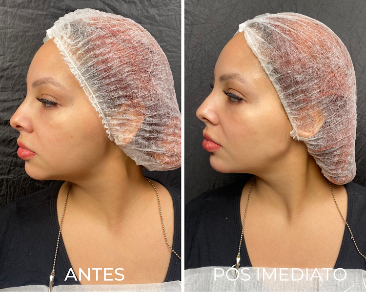 Foto 3 de Royal Face Clínica de Estética - Apucarana