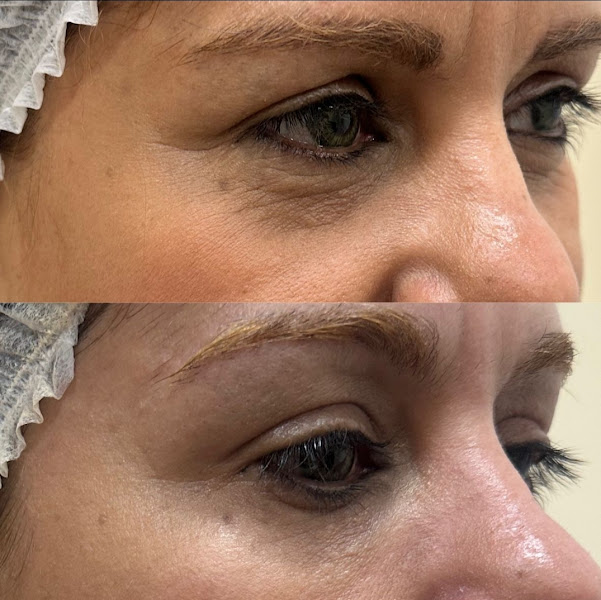 Foto 3 de Royal Face Clínica de Estética - Barão Geraldo