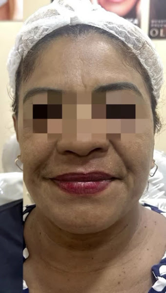 Foto 3 de Royal Face Clínica de Estética - Belém