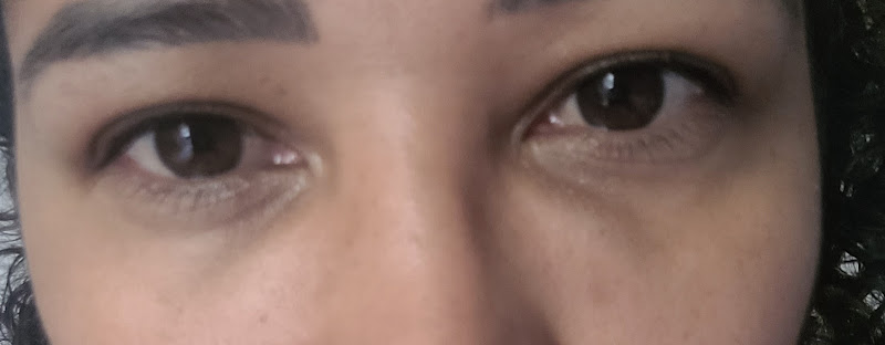 Foto 3 de Royal Face Clínica de Estética - Cachoeirinha | Harmonização Facial, Preenchimento Facial, Botox, Bioestimulador