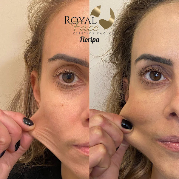 Foto 3 de Royal Face Clínica de Estética - Cachoeiro de Itapemirim