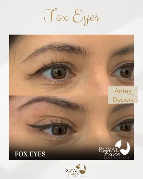 Foto 2 de Royal Face Clínica de Estética - Castanhal