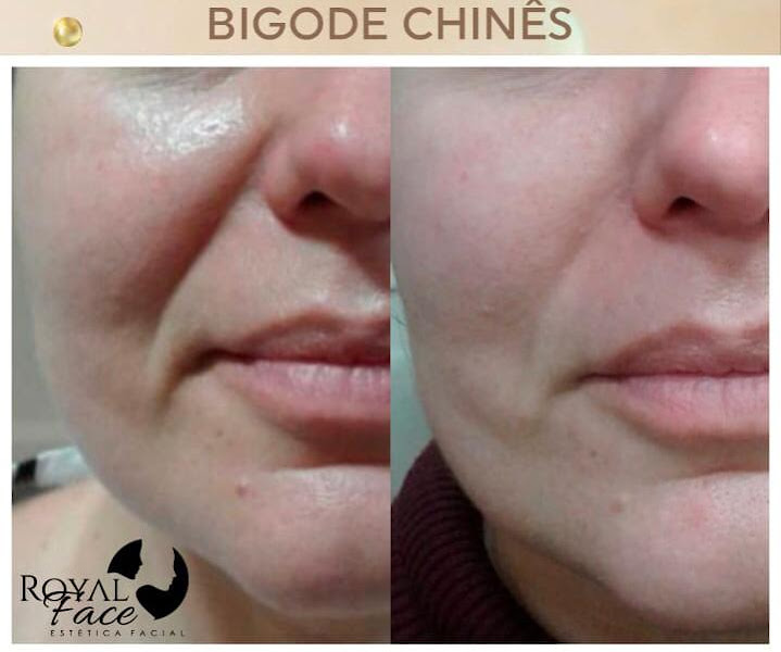 Foto 3 de Royal Face Clínica de Estética - Castanhal