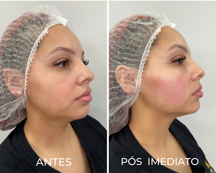 Foto 2 de Royal Face Clínica de Estética - Dourados