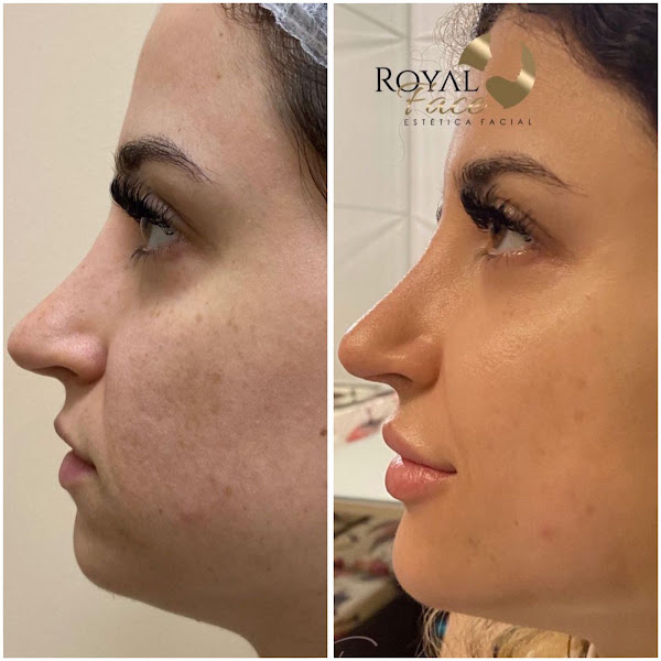 Foto 3 de Royal Face Clínica de Estética - Embu das Artes