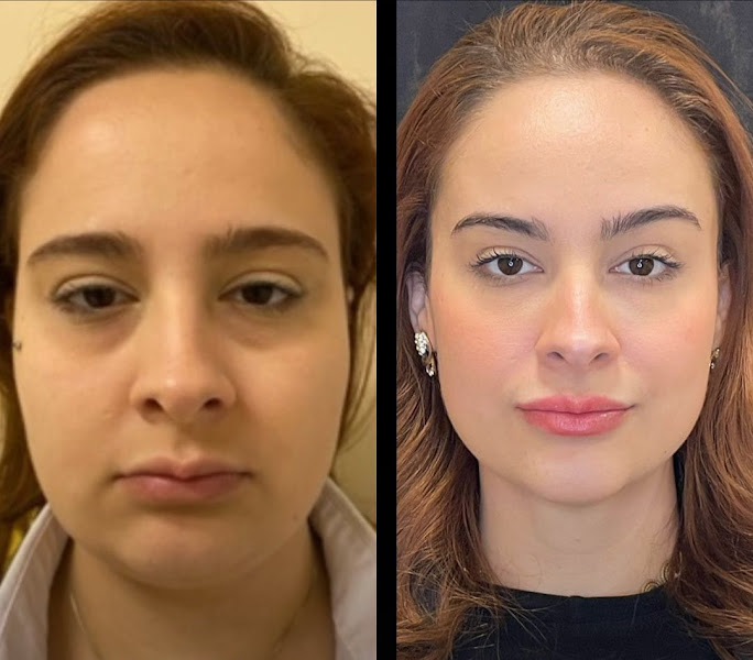 Foto 2 de Royal Face Clínica de Estética - Itu