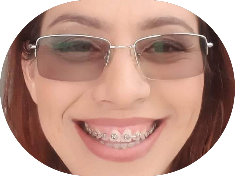 Foto 5 de Royal Face Clínica de Estética - Mossoró