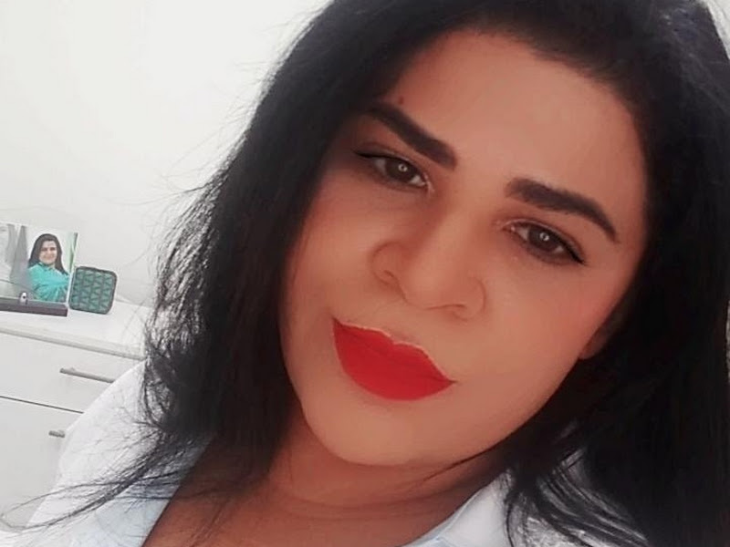 Foto 7 de Royal Face Clínica de Estética - Mossoró