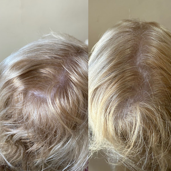 Foto 3 de Royal Face Clínica de Estética - Pindamonhangaba