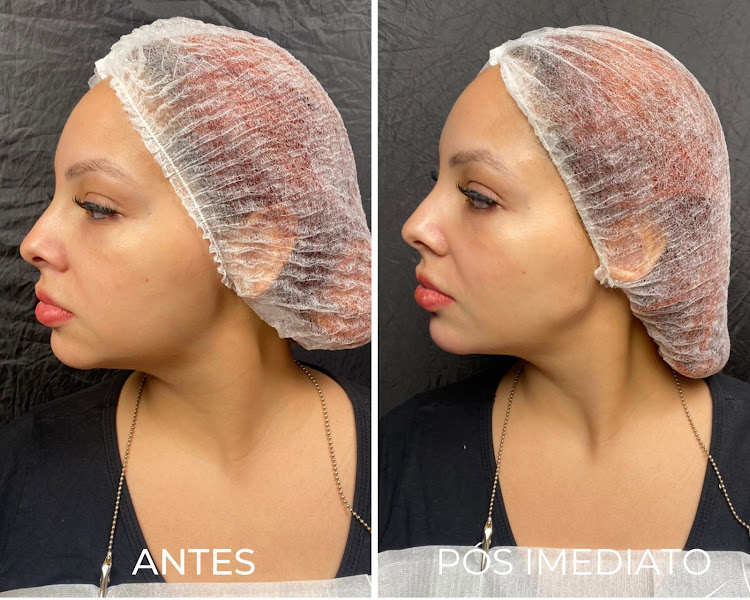 Foto 3 de Royal Face Clínica de Estética - Porto Alegre