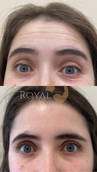 Foto 3 de Royal Face Clínica de Estética - Rio Grande