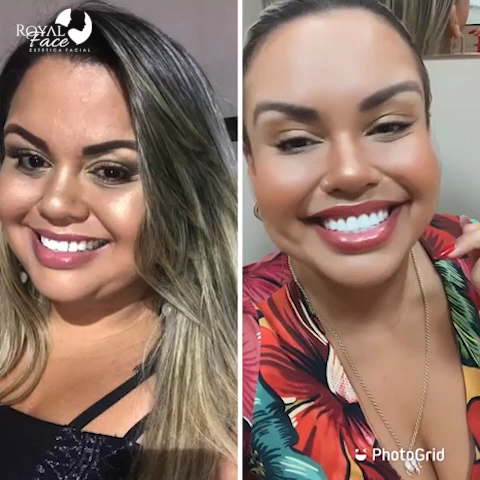 Foto 3 de Royal Face Clínica de Estética - Santana de Parnaíba