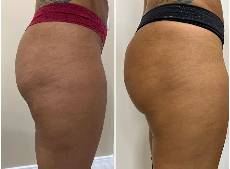 Foto 2 de Royal Face Clínica de Estética - São José dos Pinhais