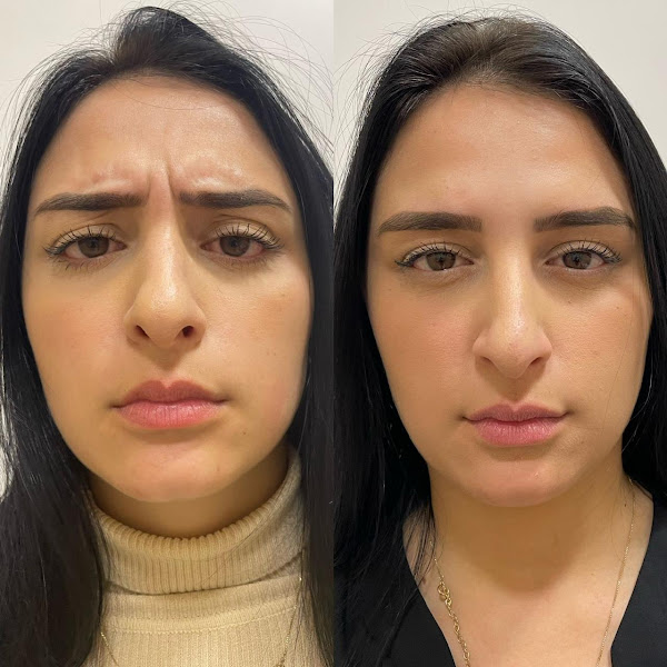 Foto 3 de Royal Face Clínica de Estética - São José dos Pinhais