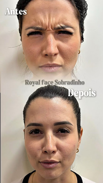 Foto 3 de Royal Face Clínica de Estética - Sobradinho