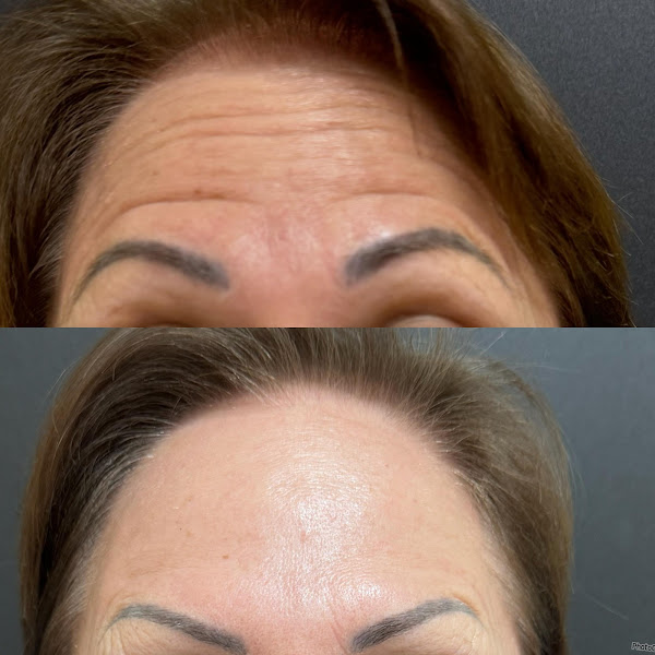 Foto 3 de Royal Face Clínica de Estética - Toledo