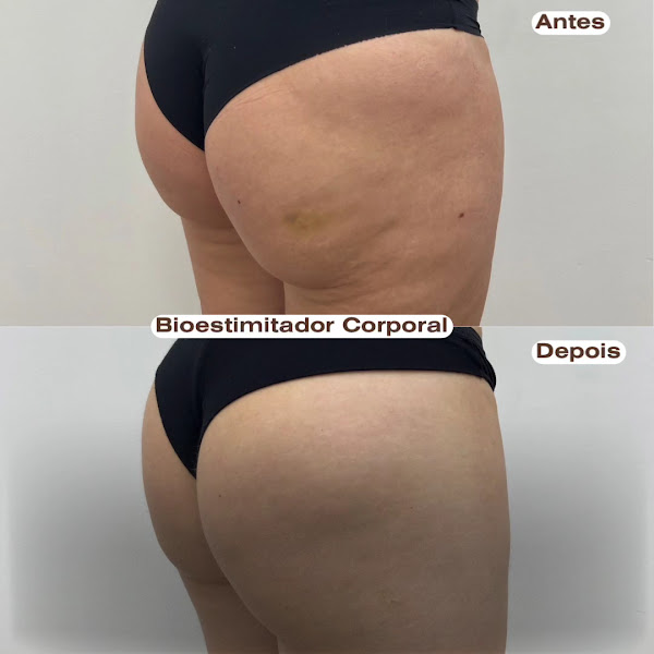 Foto 3 de Royal Face Clínica de Estética - Vila Matilde