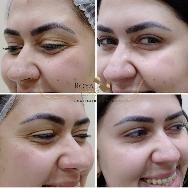 Foto 3 de Royal Face