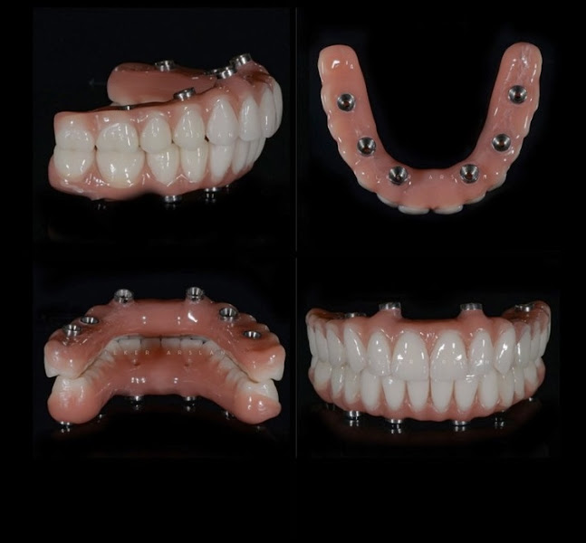 Foto 3 de Royal Implantes