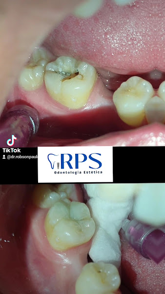 Foto de RPS Odontologia Estética