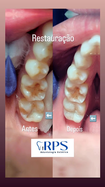 Foto 2 de RPS Odontologia Estética