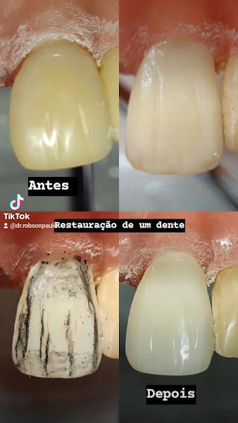 Foto 3 de RPS Odontologia Estética