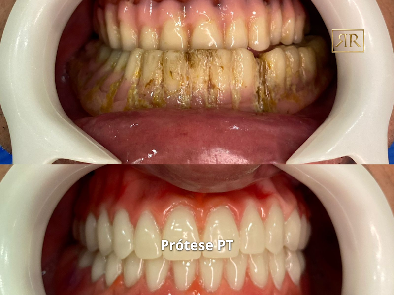 Foto 3 de RR Odontologia | Dentista Guarulhos