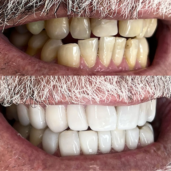 Foto 2 de RR Odontologia Estética