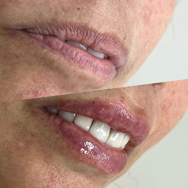 Foto 3 de RR Odontologia Estética