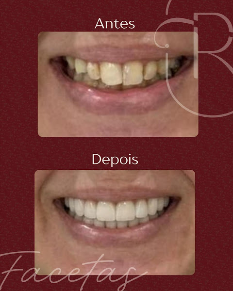 Foto 3 de Rudini Odontologia | Implante Dentário | Dentista | Vila Nogueira | Campinas - SP
