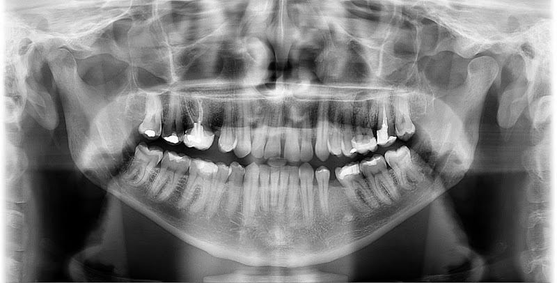 Foto 2 de RUNI Odontologia de resultados - Unidade Sapopemba