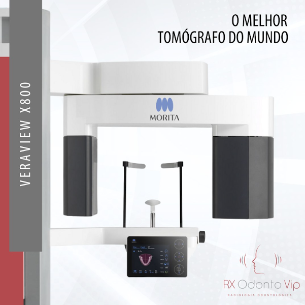 Foto 3 de RX ODONTO VIP Maringá | Tomografia e Radiografia Odontológica